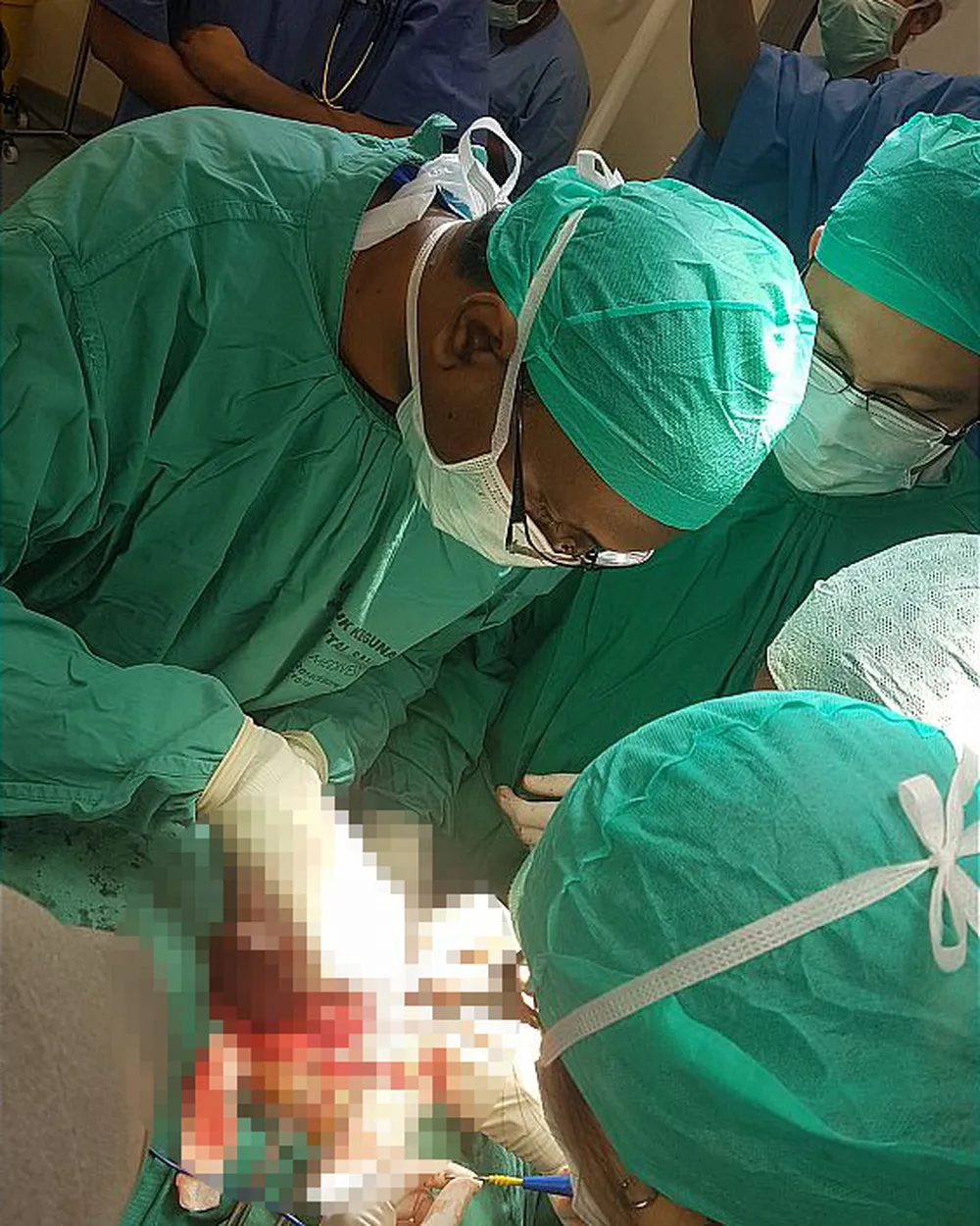 Close-up of an ENT operation